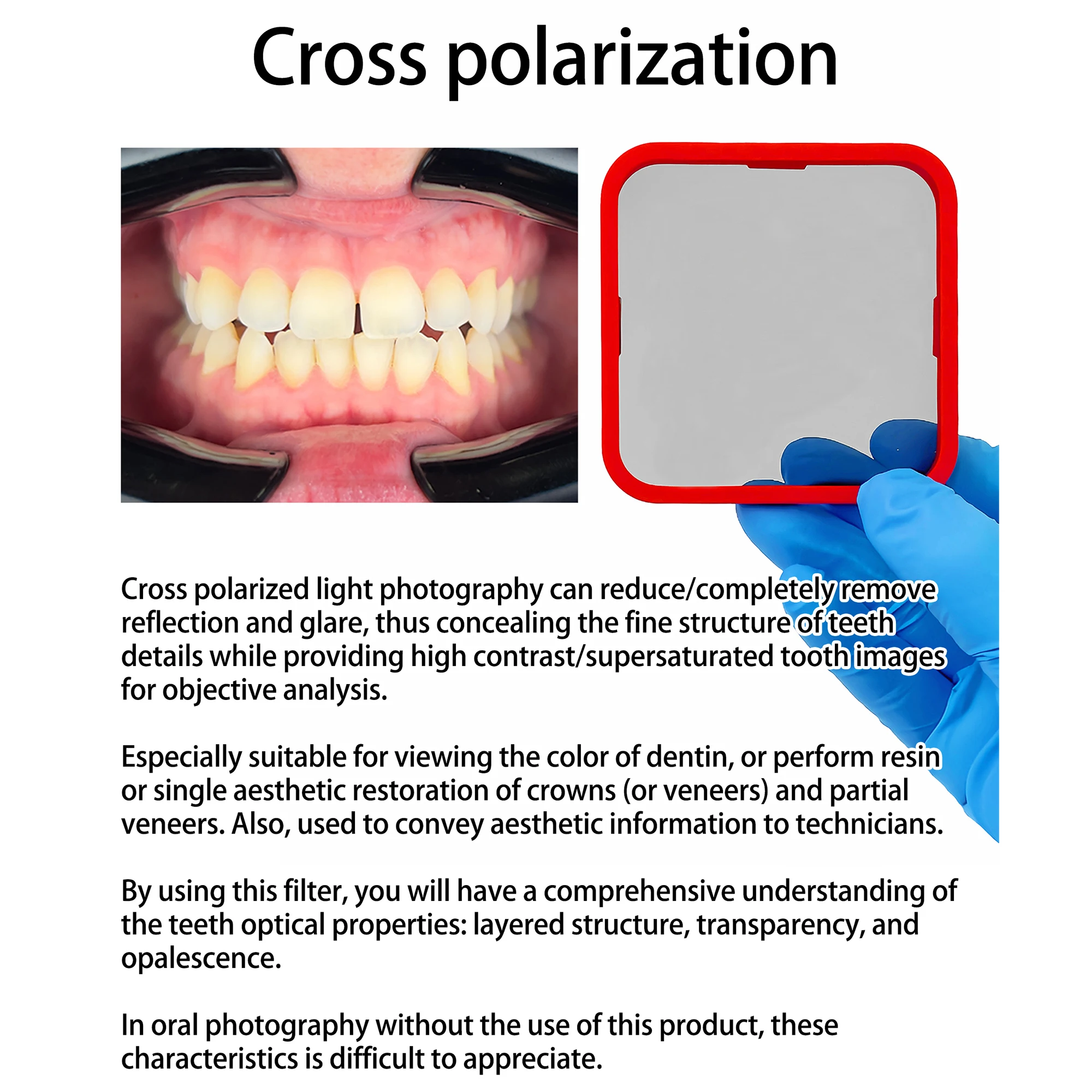 Parlamadan Ağız Fotoğrafları - Diş Fotoğrafçılığı İçin Çapraz Polarizasyon Seti - Diş Hekimi Tedavisi Fotoğraf Video CPL Polariod Filtresi