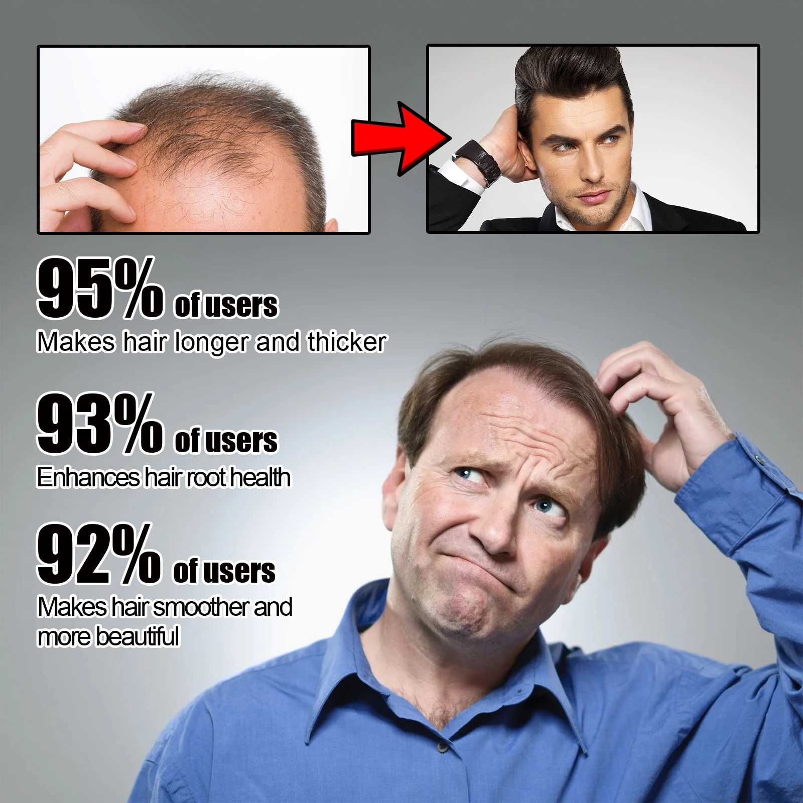 Hoegoa 100 مللي رذاذ نمو الشعر للرجال تغذي جذور الشعر مكافحة الصلع تدليك تقليل التجعد سبليت ينتهي رذاذ العناية بالشعر الكثيف #4