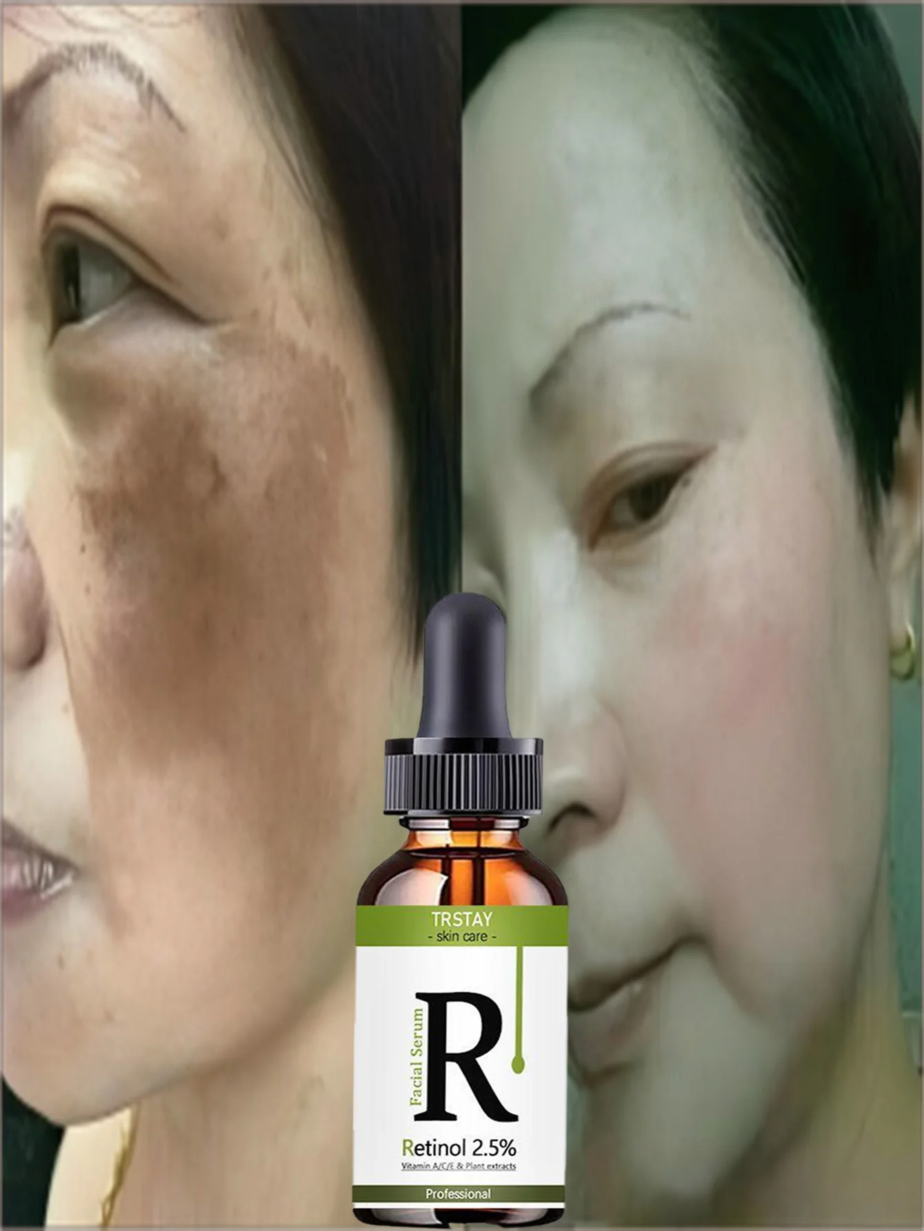 Hydrating Anti Wrinkle Serum Repair Collapsed Barriers Gently Soothe Sensitivity Restore Tender Touch Smooth Skin Facial Treatme - Image 2