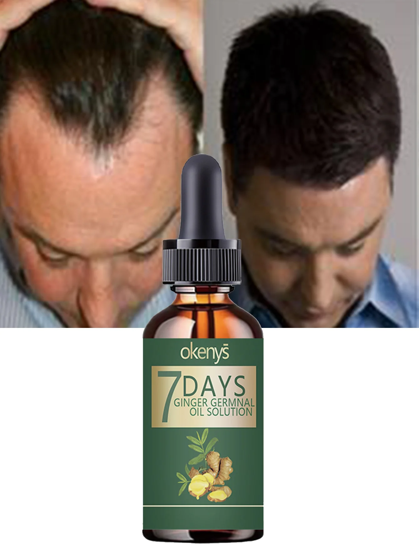 Moisturizing Scalp Hair Dual Oil Hydration Treatment for Dry Damaged Hair Deep Nourishment with Argan Jojoba Oils Hair Repair So - Image 2