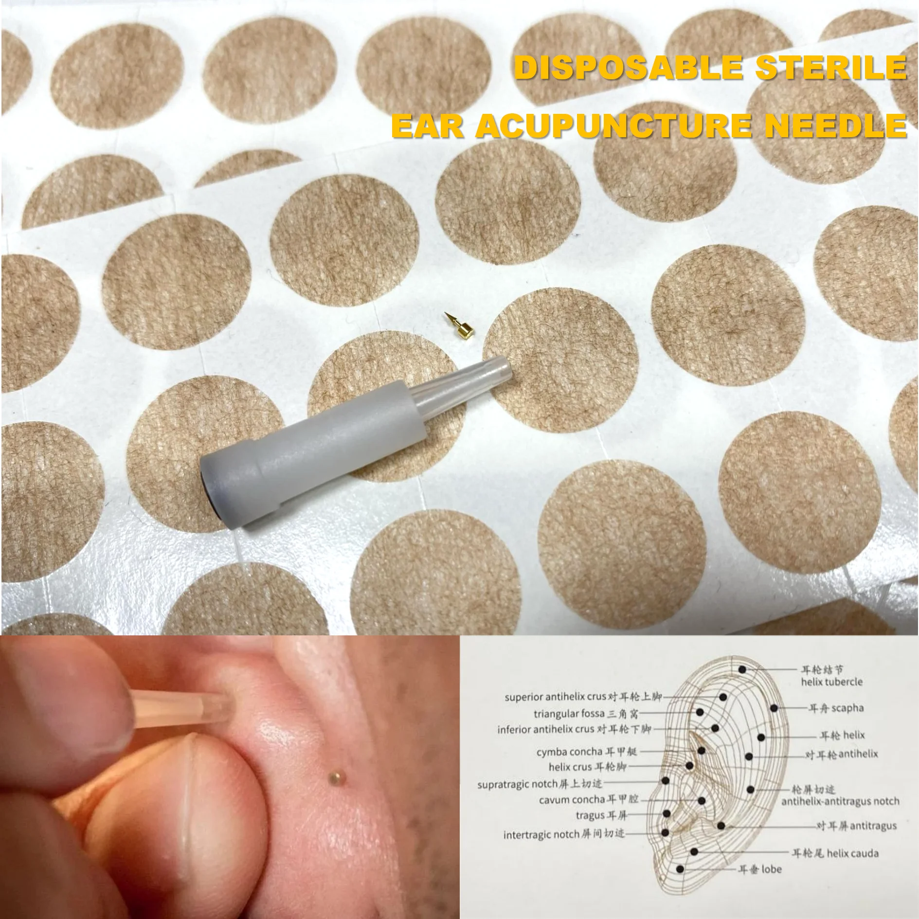 100pcs/box Ear Acupuncture Needles Press Needle Sterile Auricular Acupunture Ear Needle Acupuncture Points for Single Use