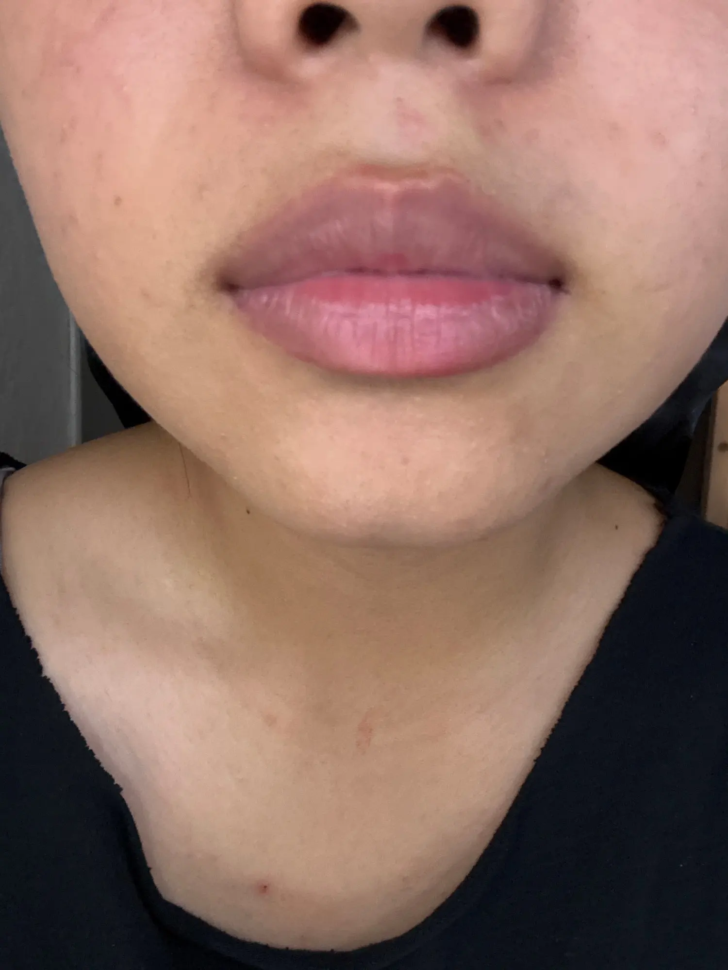 Customer review photo