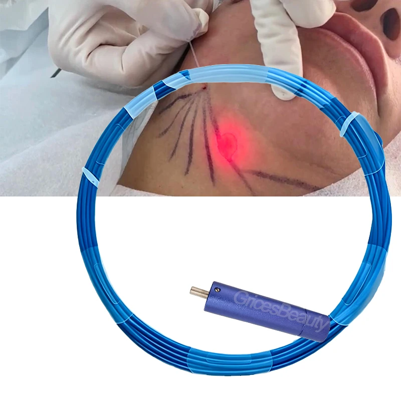

SMA905 Connector 1470nm Diode Laser 3m Fiber 600um Radial Tip Optical Fiber Fat Dissolving Body Contouring Machine Consumables