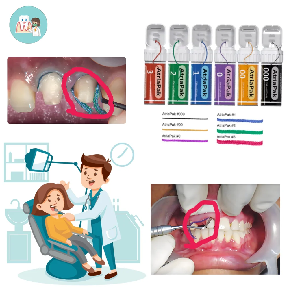 

Dental AtriaPak Knitted Gingival Non-Medicated Retraction Cords 254cm long,Disposable Retraction Gum Lines 5 sizes available