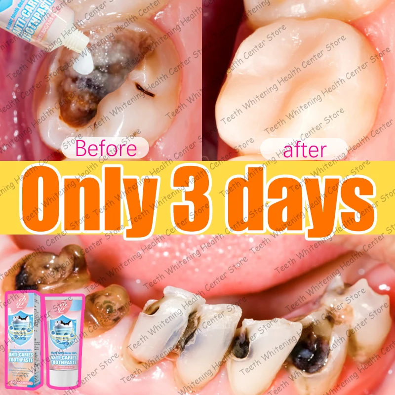 

Black technology repairs tooth decay