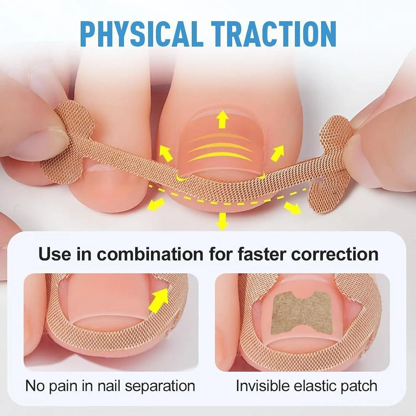 Ingrown Nail Correction Kit Nail Art Tools Elastic Breathable Ingrown Fingernail Corrector Professional Efficient For All Nail