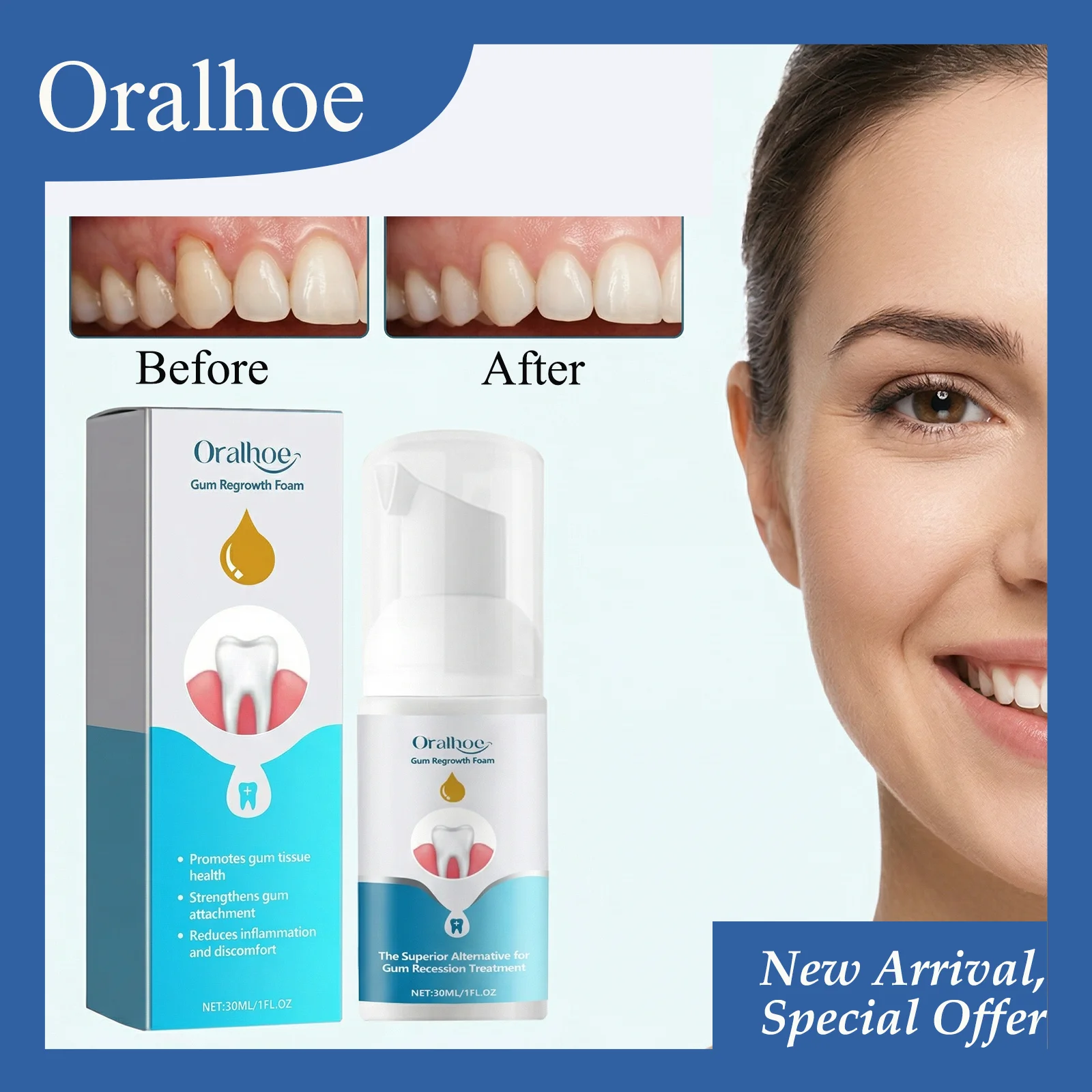 

Пена для восстановления десен ORALHOE 30 мл: Восстанавливает правильное прикрепление десен, предотвращает дальнейшее растяжение, обеспечивает эффект освежения дыхания.
