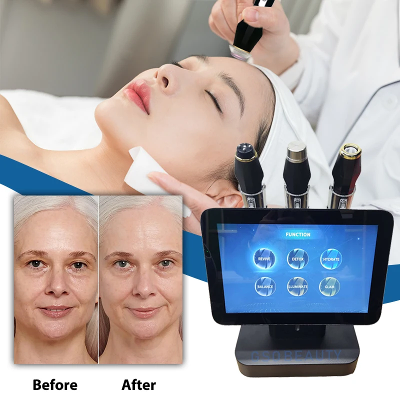 3 In 1 Oxygeneos Co2 Bubble Oxygen Facial Lifting rf Exfoliation Ultrasound Skin Glow RF Machine for facia Refreshing Cleansing