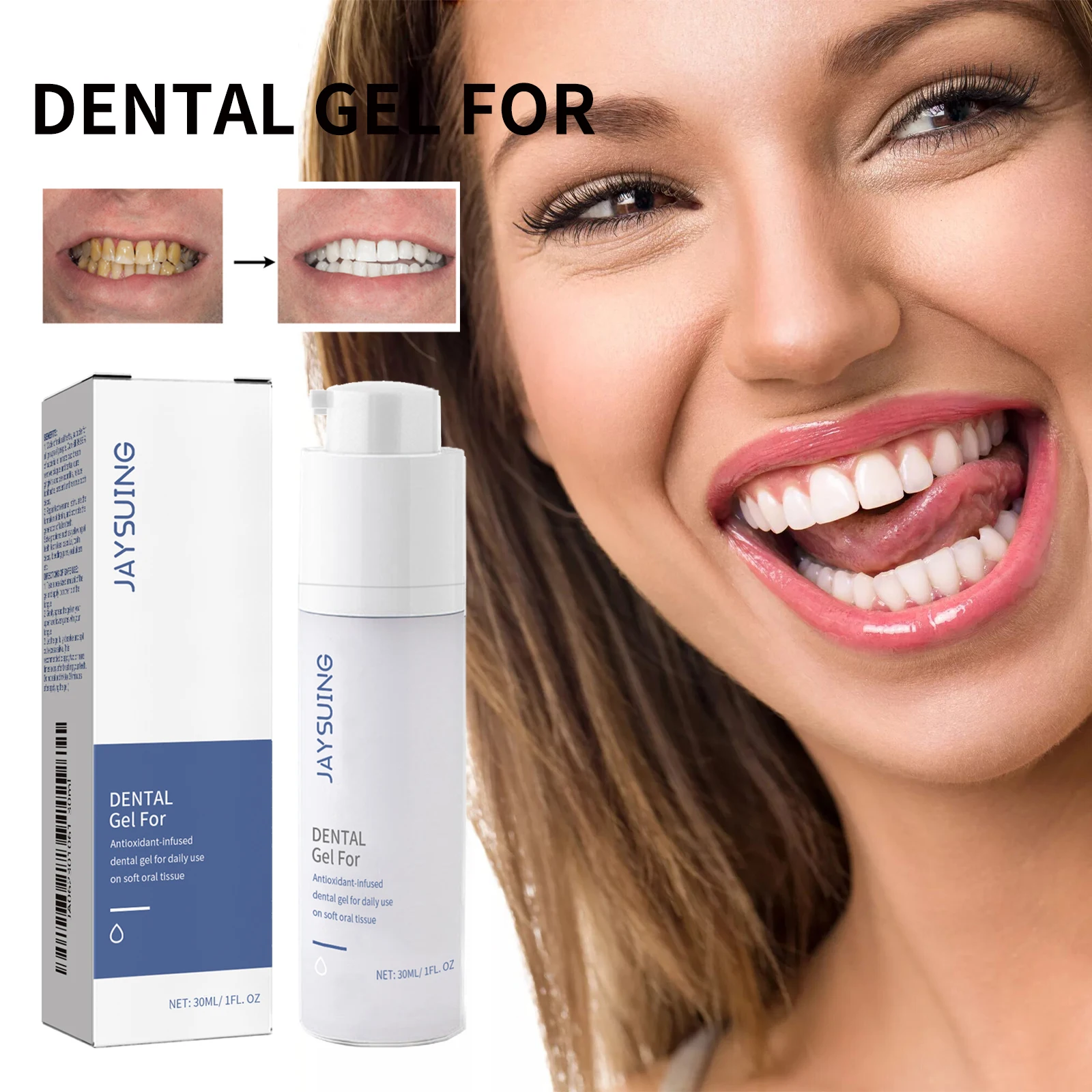 Placa de Gel Dental, reparación de encías de defensa, elimina las manchas, previene la caries, aliento fresco, blanqueamiento botánico a base de hierbas, Gel de tratamiento Oral