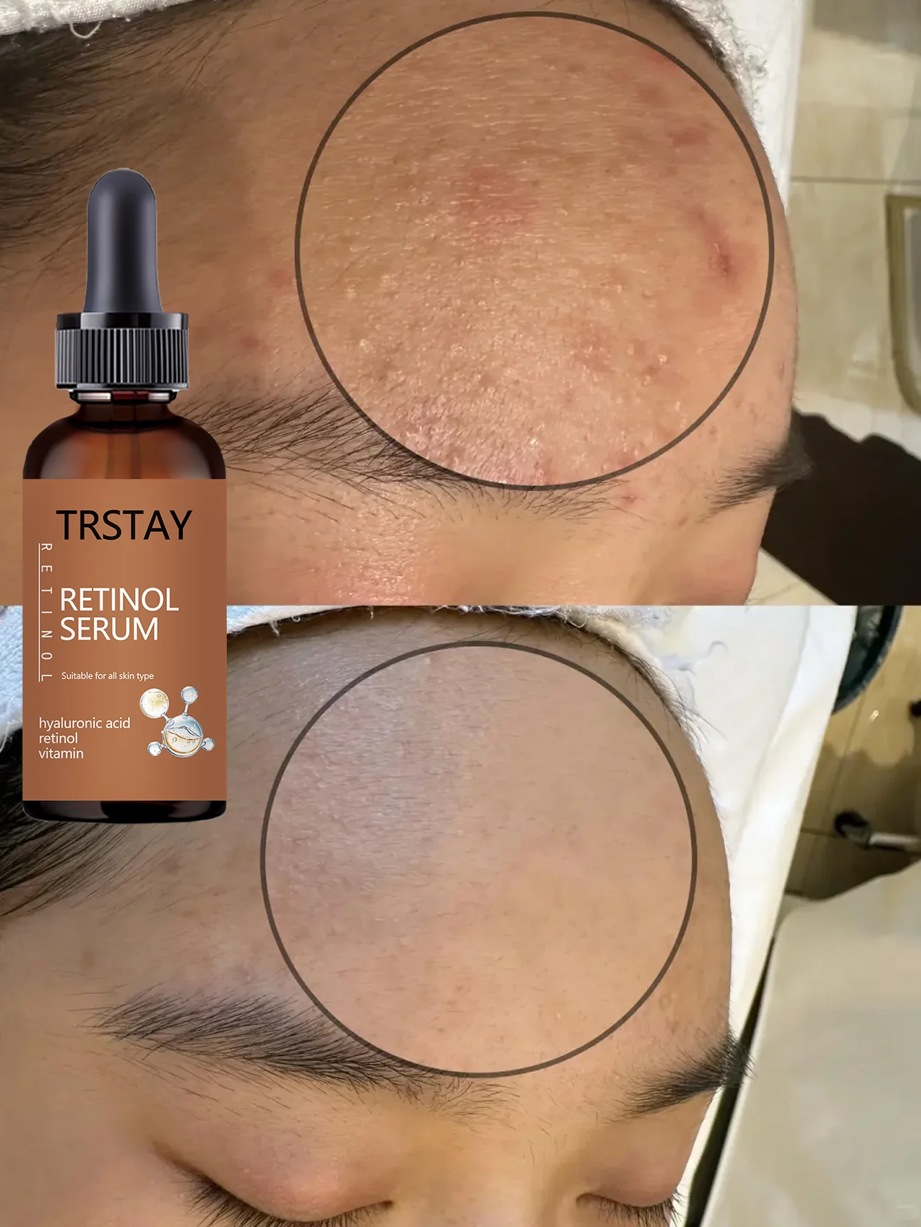 Hydrating Facial Oil for All Skin Types 24H Moisture Lock Nourishing Serum Instant Relief Essential Hydration Skin Care Treatmen