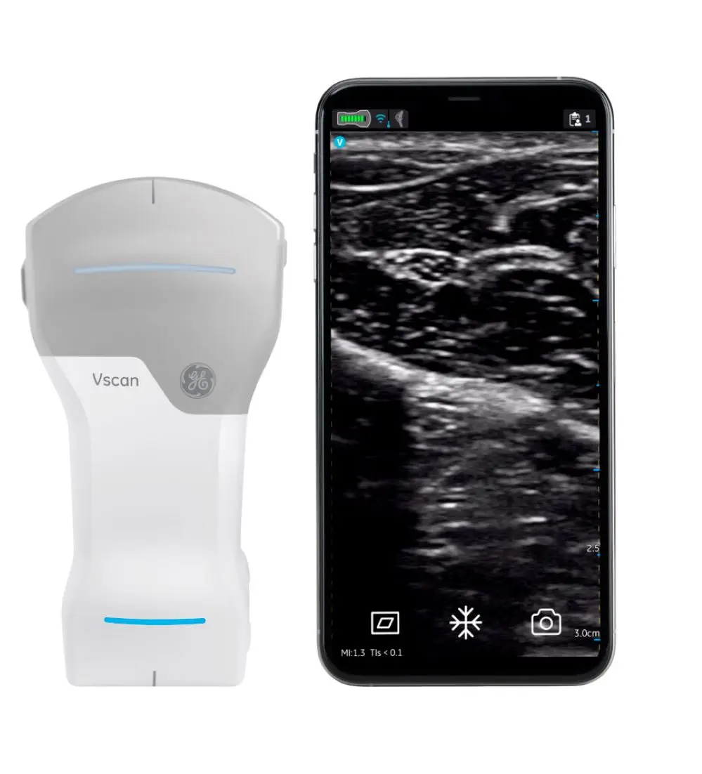 100% OFFICIAL SALES Vscan-Air-CL-Wireless-Ultrasound