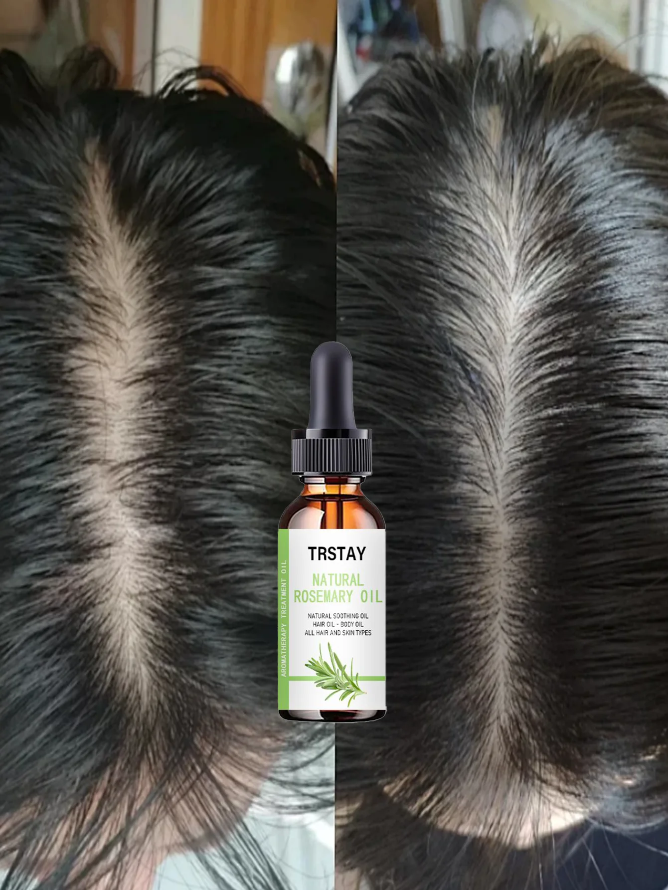 Professional Hair Treatment Oils for Nourishing Growth Tame Dry Hair Develop Smooth Style Various Specs All Hair Types Moisturiz - Image 6