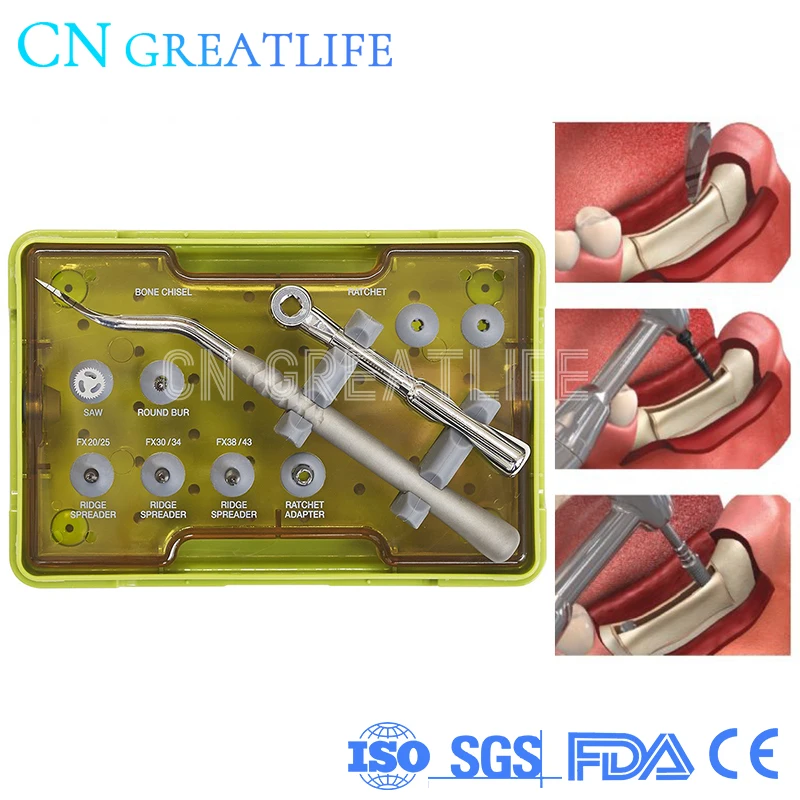 100% Original Dentium XRSK Dental Implant Surgery Tools Dentium Ridge Spreader Drills RS Kit