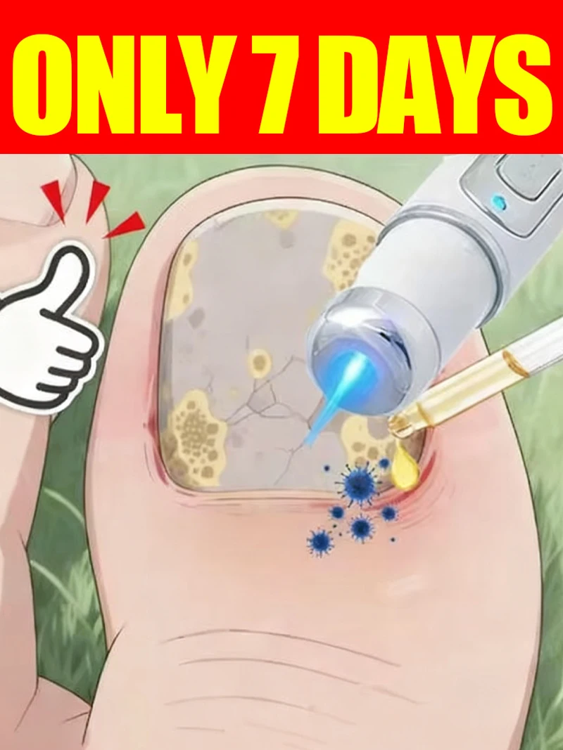 

Generation-2 Laser Says Goodbye To Bad Manicure In 7 Days