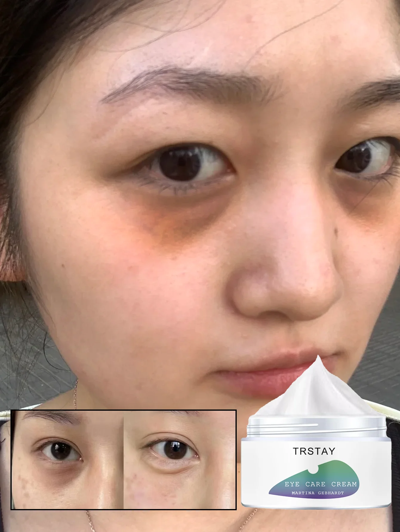 Moisturizing Eye Cream for Dark Circles and Puffiness Fade Away Vanish Lightly Penetrates Repelling Dullness Brightening Eyes wi