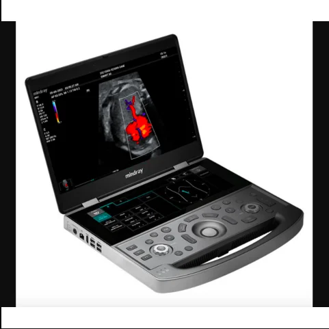 BEST SELLER Mindray MX7 Dedicated Portable Ultrasound System New in stock