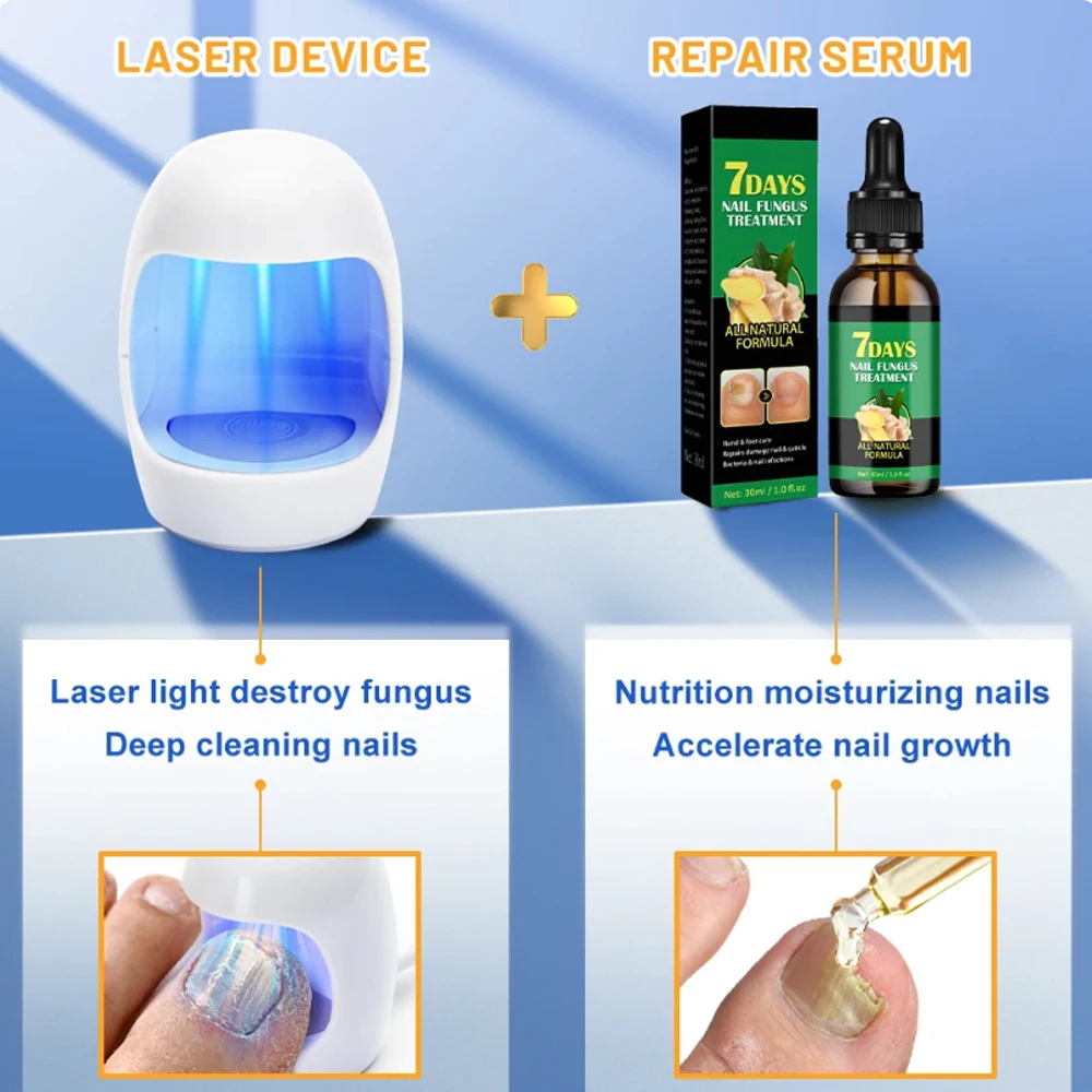 Fungus Nail Laser Treatment Device Repair Toenail Fingernail Essential Oil Onychomycosis Treat Toenail Nail Fungal Treatment