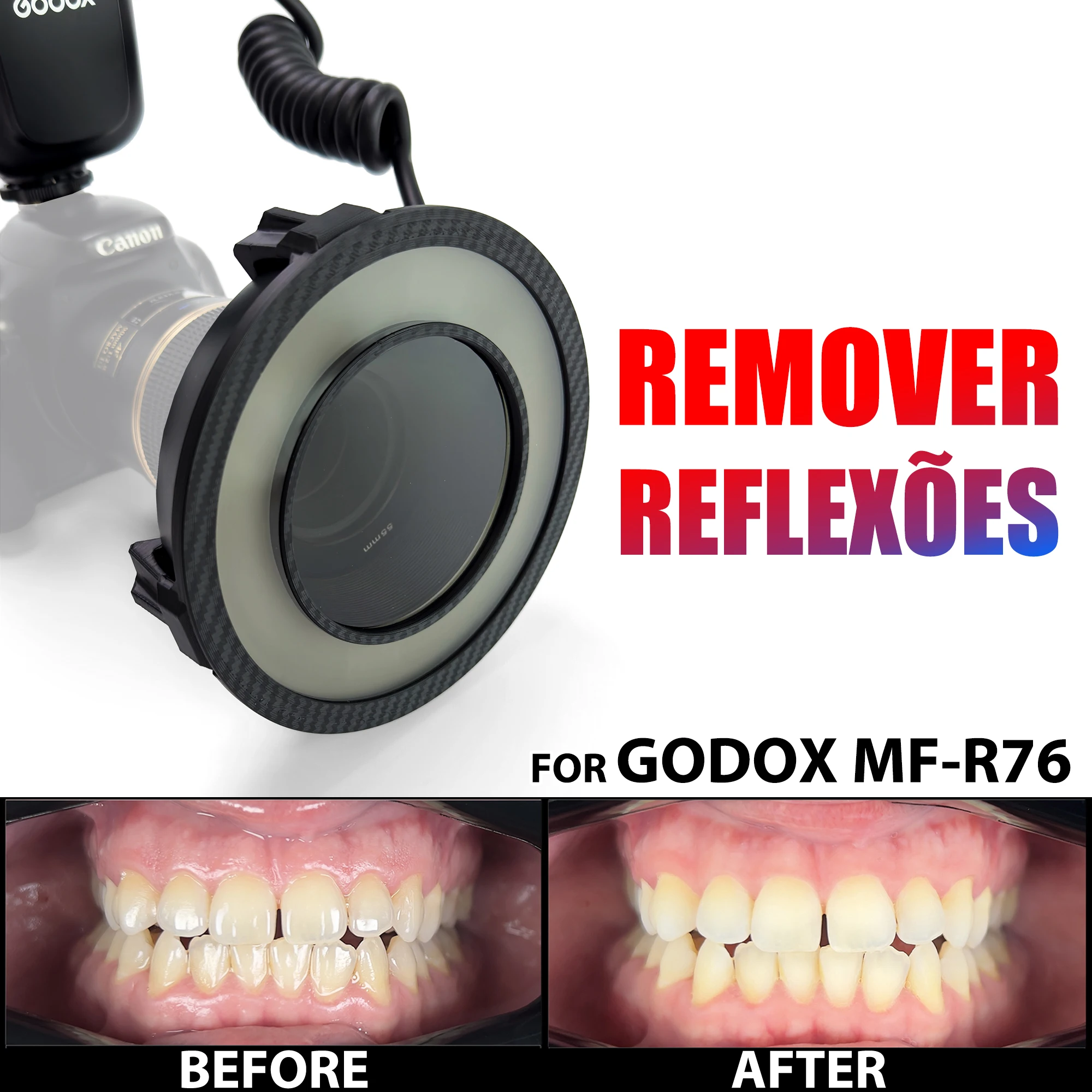 Foto Dentária. Filtro polarizador para Godox MF-R76. Sem refletores e sem brilho Acessórios para flash de câmera de fotografia dentária
