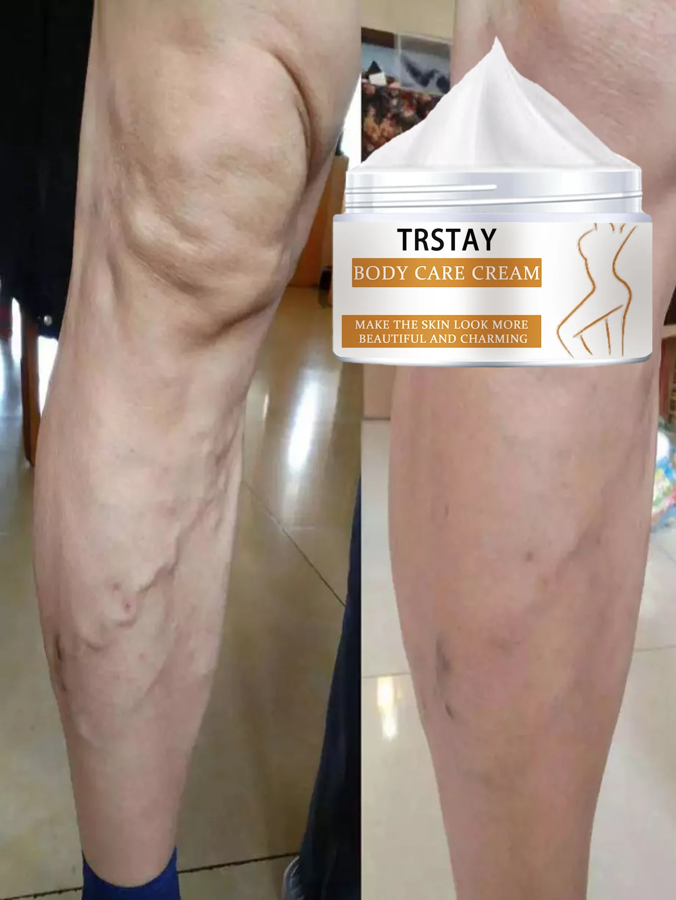 

Увлажняющий крем для тела от варикозного расширения вен, глубокое увлажнение, длительное питание, гладкая текстура кожи, масло ши, обогащенное масло