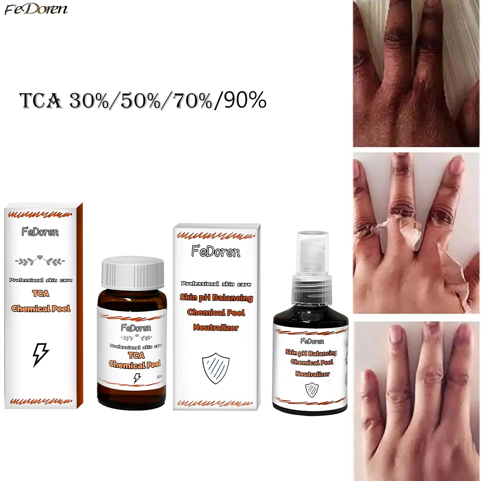 TCAAcid para pele escura, Suavidade corporal, pele morta, esfoliante hidratante, produto químico de alta potência, Peeling, 50%, 20%, 30ml