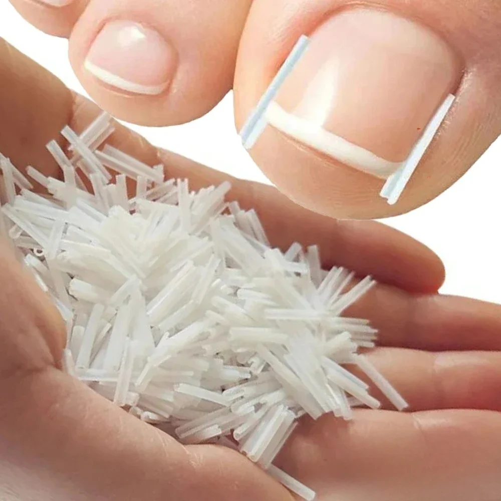 Correction des ongles incarnés, traitement des ongles Ultra-fin, Patch élastique autocollant, redressage des ongles, rainure incarnée, 1 à 100 pièces