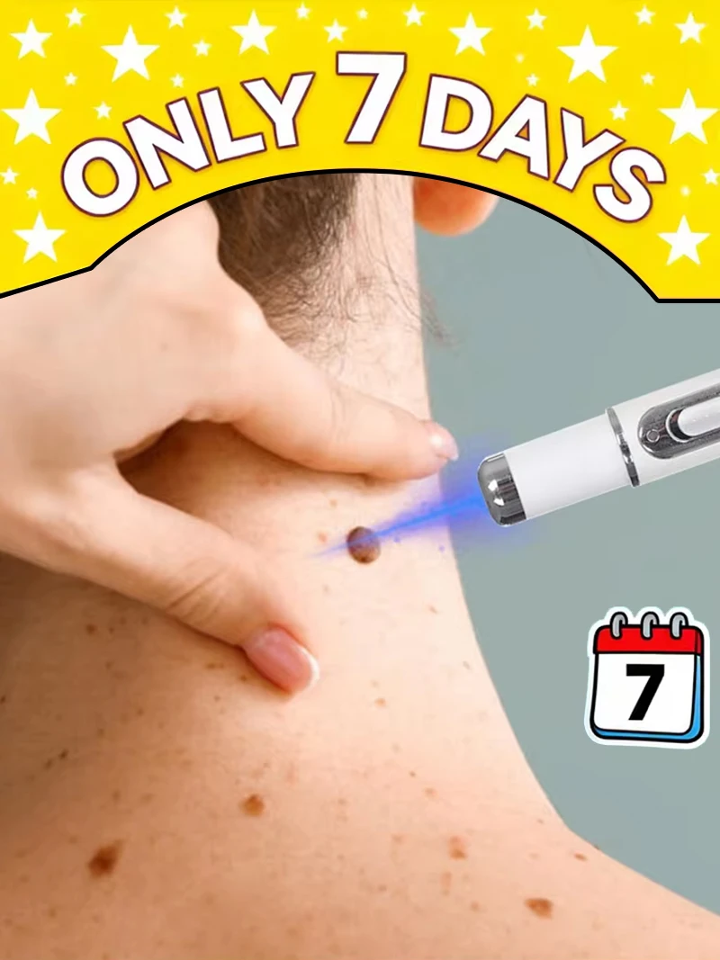 2026NEW blue light pen to solve neck warts, wart care tools
