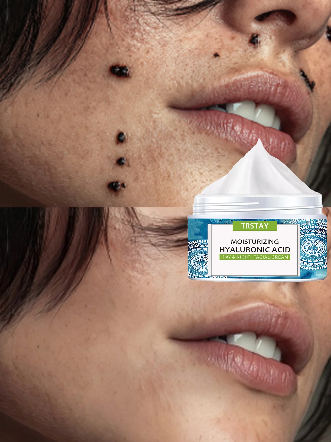 

Увлажняющий и разглаживающий крем для лица для уменьшения местной глибины, увлажняющая сыворотка с успокаивающей формулой для всех типов кожи