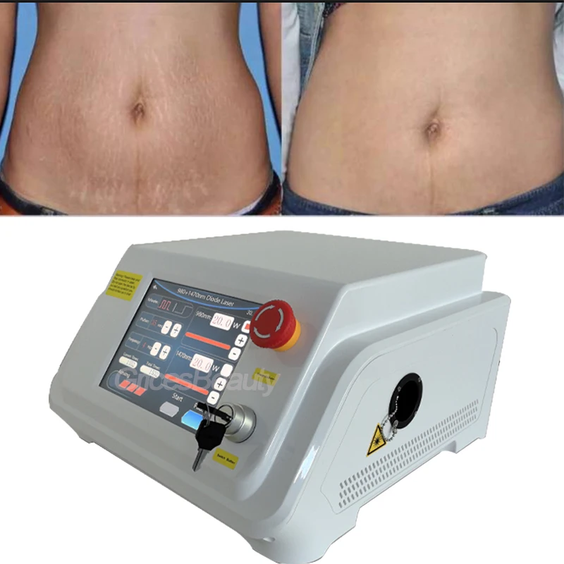 

2026 Newest 980nm 1470nm Dual Wavelength 40W Diode Laser Device for Vascular Skin Care Therapy Facial Lifting Weight Loss