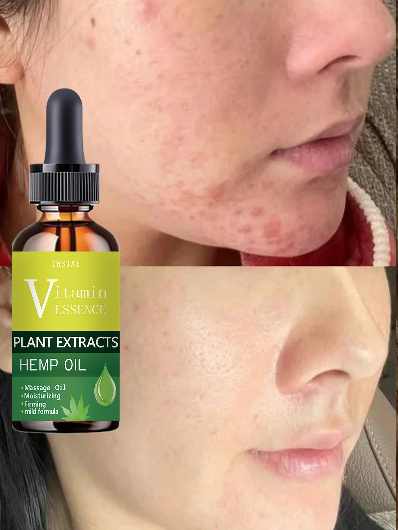 Hydrating Spot Removing Anti Wrinkle Brightening Firming Lifting Facial Serum for Radiant Youthful Skin with Deep Hydration and - Image 5