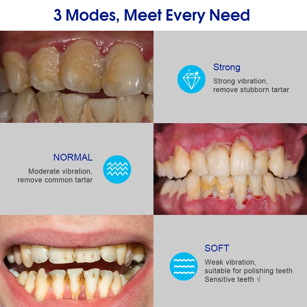 Détartreur dentaire électrique avec miroir buccal, soins bucco-dentaires pour le tartre, dissolvant de calcul SAF, nettoyeur de dents, kit de blanchiment des dents