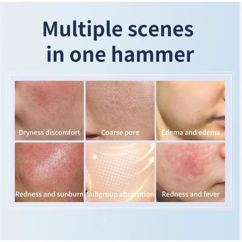 أداة تجميل منزلية لشد ضغط الثلج لشد البشرة وتجديد شبابها ومطرقة ثلج محمولة أداة ضغط بارد