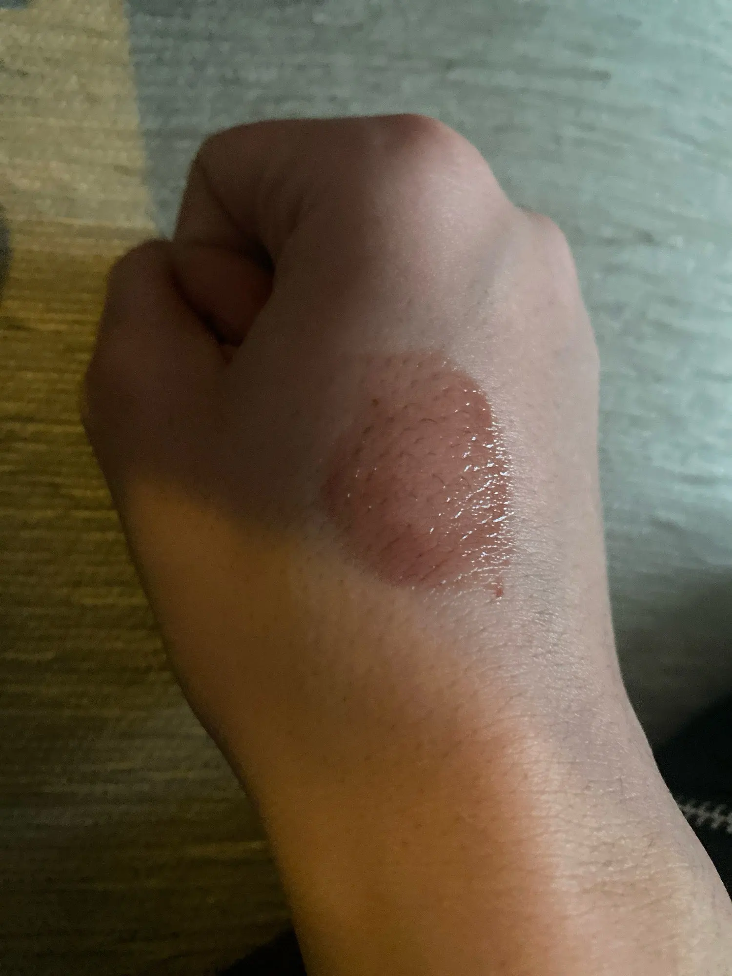 Customer review photo