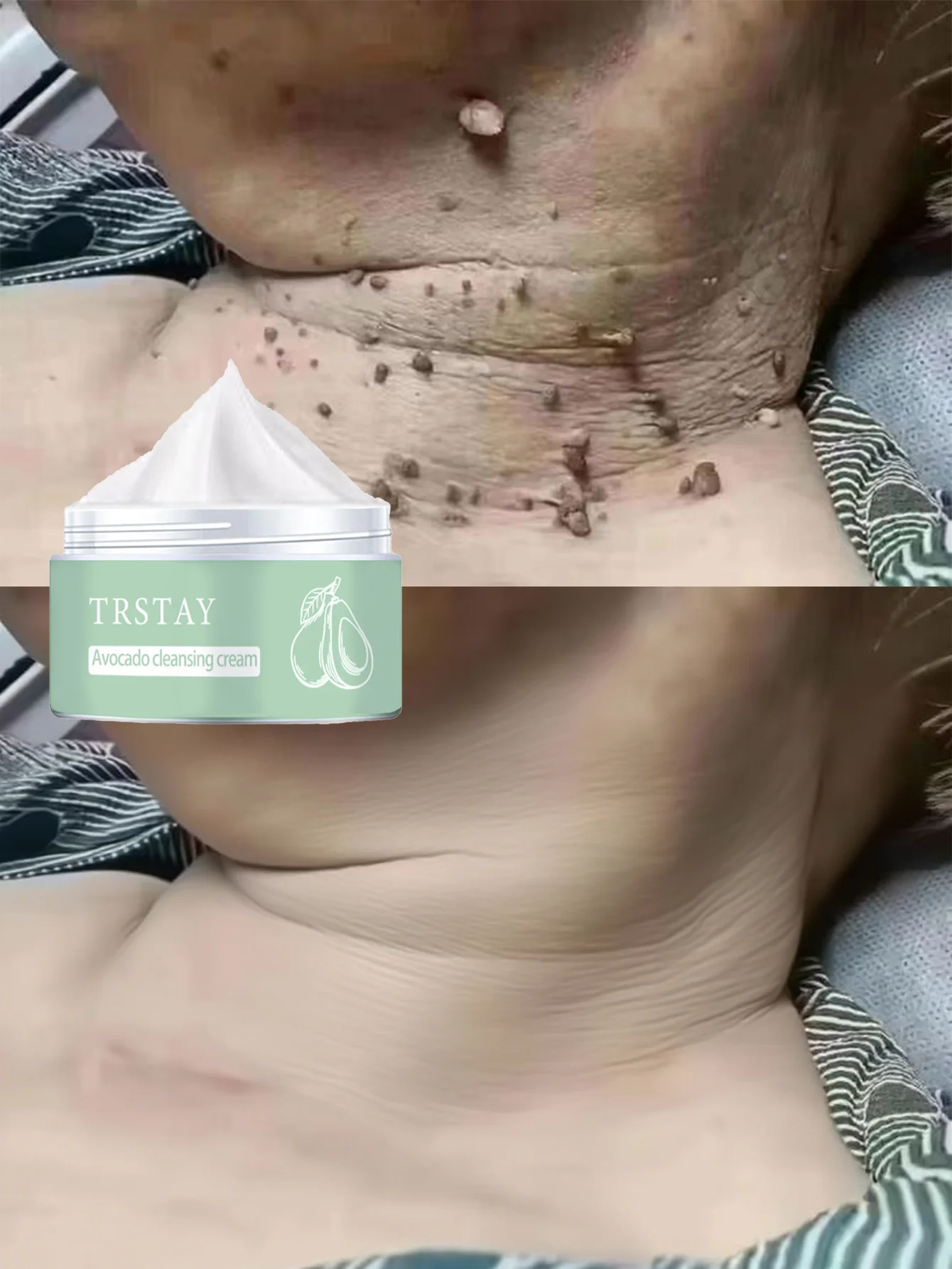 

Hydrating Body Cream Deep Moisture for Rough Skin Long Lasting Hydration Nourishes and Softens Skin Perfect for Dry Skin Care Da