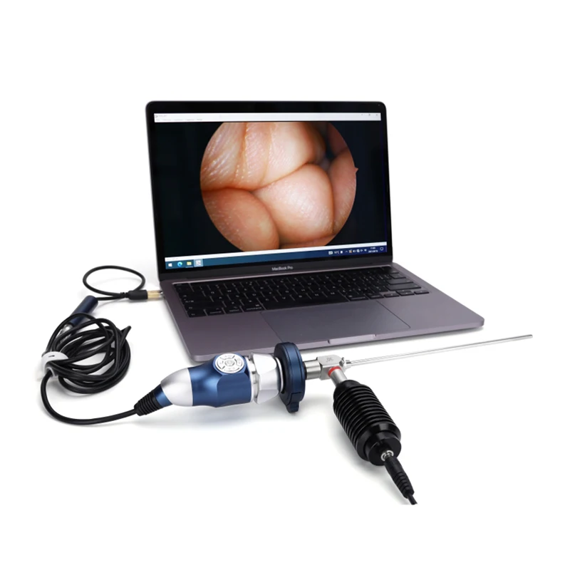 Medical Endoscopy ENT Surgery USB Full HD 1080P HDMI Endoscope Camera with Magnetic Light Source