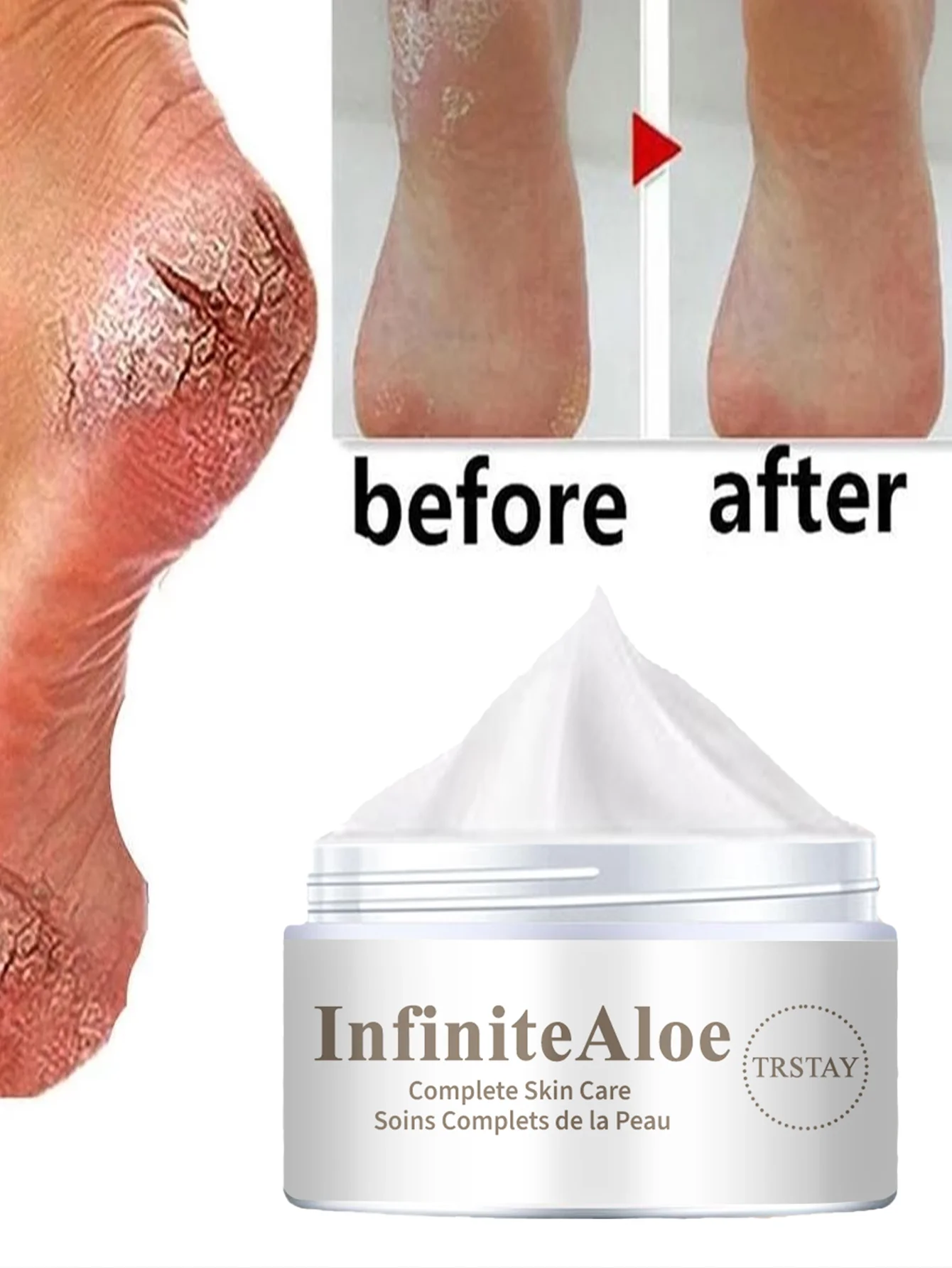 

Увлажняющее масло для ног для потрескавшихся пяток Быстрое впитывание Увлажняющее лечение Глубоко питательное восстановление сухой кожи Интенсивный уход за S