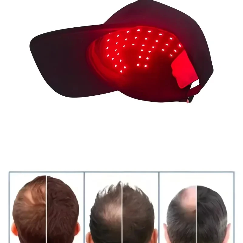 70 LED Hair Growth Cap Red Blue Light Therapy Infrared Scalp Massager Anti Hair Loss Regrowth Heating Hat