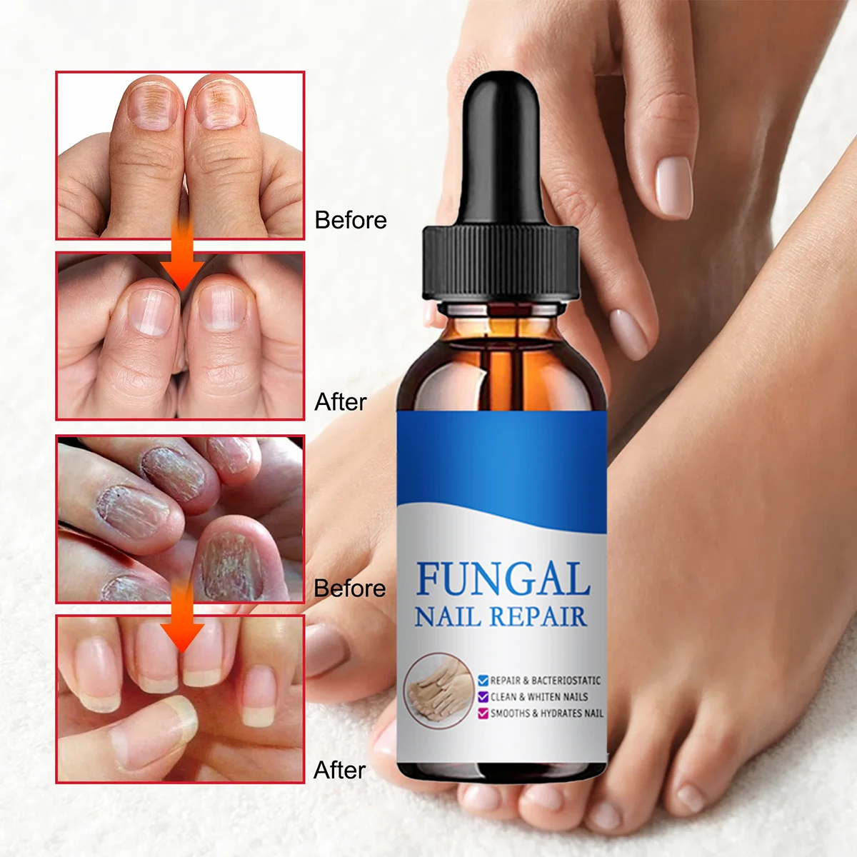 TRSTAY Pilz Nagel Behandlung Fuß Reparatur Essenz Pflege Bleaching Zehen Nagel Pilz Entfernung Gel Anti Infektion Gesundheit Pflege