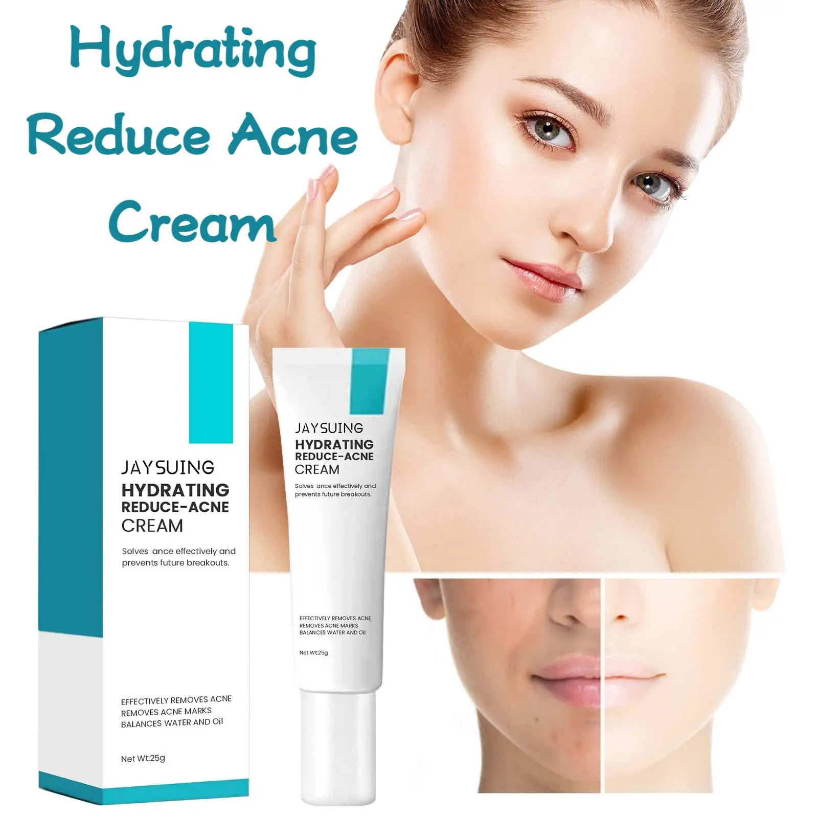 

Jaysuing 25g Anti Acne Cream Facial Care Improve Dry Skin Moisturize Face Pimple Remove Oil Control Hydrating Acne Healing Cream