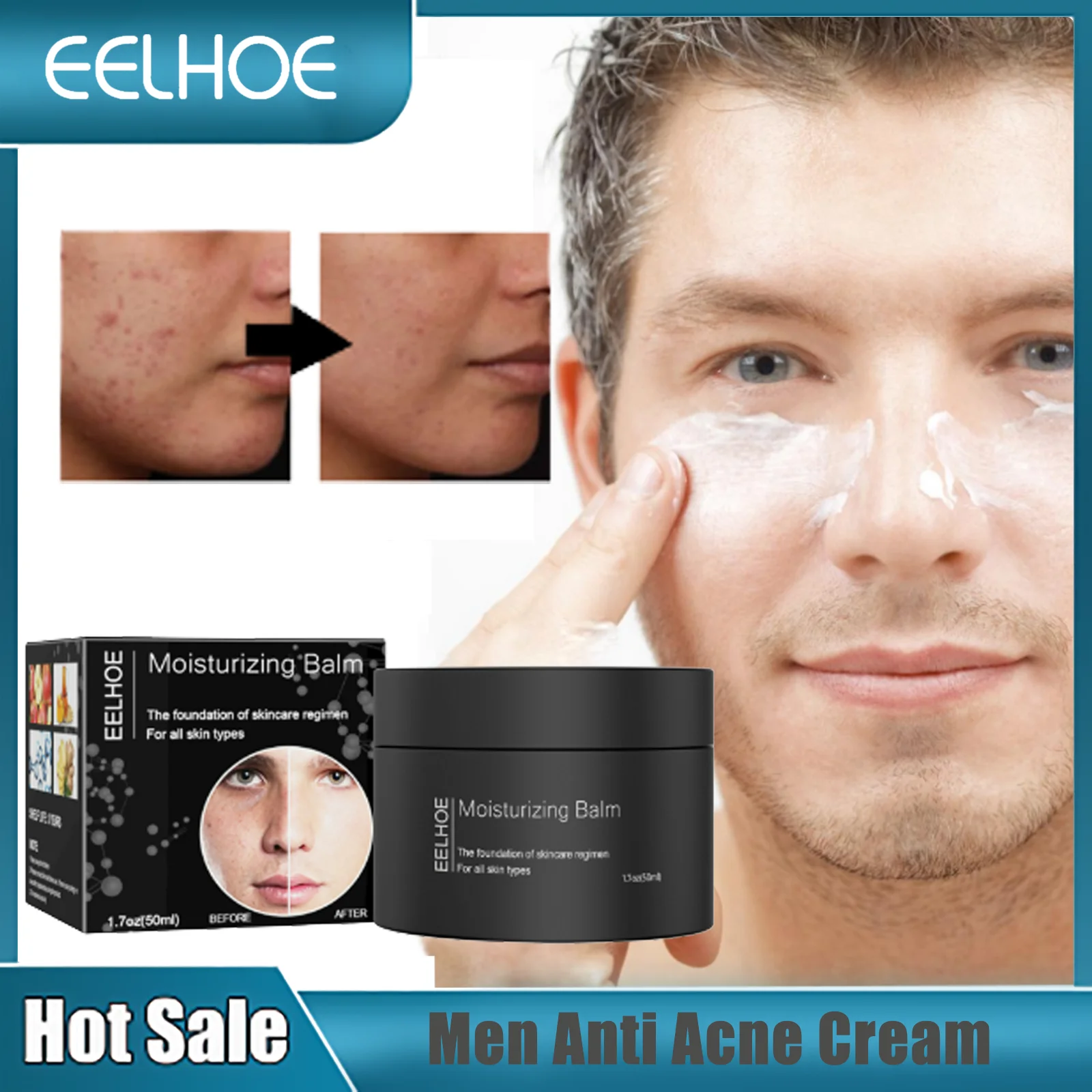 

Men Acne Treatment Cream Pimple Removal Fade Acne Mark Anti Wrinkle Oil Control Shrink Pore Hydrate Whitening Moisturizing Cream