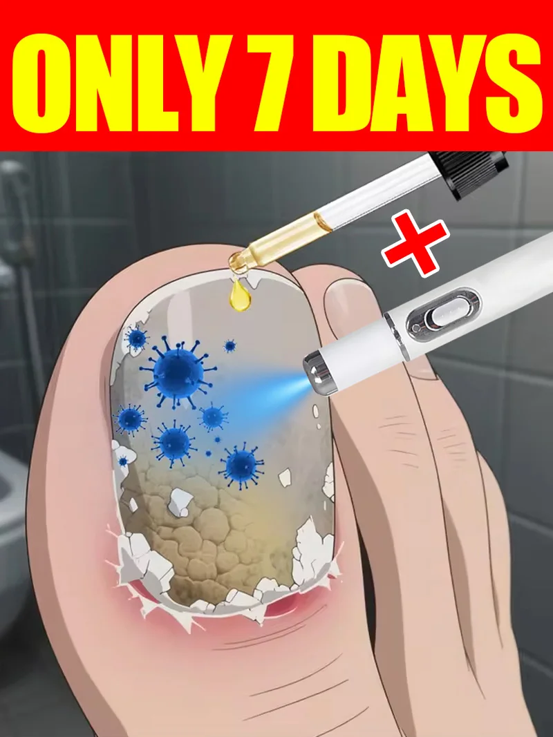 

Generation-2 Laser Says Goodbye To Bad Manicure In 7 Days