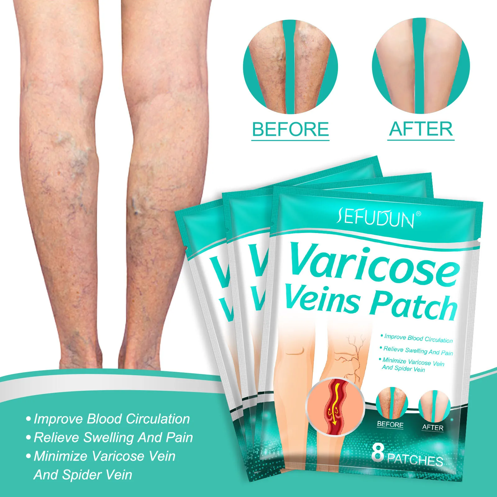 Varicose Veins Patch Improve Blood Circulation Relieve Swelling and Pain Minimize Spider Vein Treatment for Legs Soothing 8 Pcs