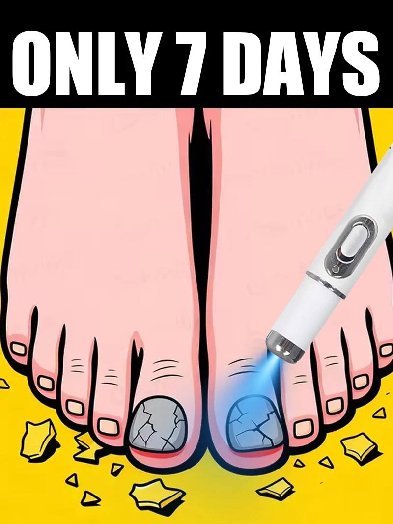 2025 Hot Sellers: Nail Cleaning Tools, Blue Light Laser Tools Root Repair Upgraded to Second Generation