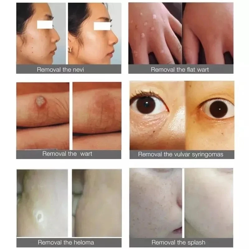 جهاز تجميل لشد الجلد سحري مضاد للتجاعيد ، جهاز ترفيهي للطاقة للعناية بالعينين ، إزالة أكياس العين ، شد الجلد ، منتج شائع