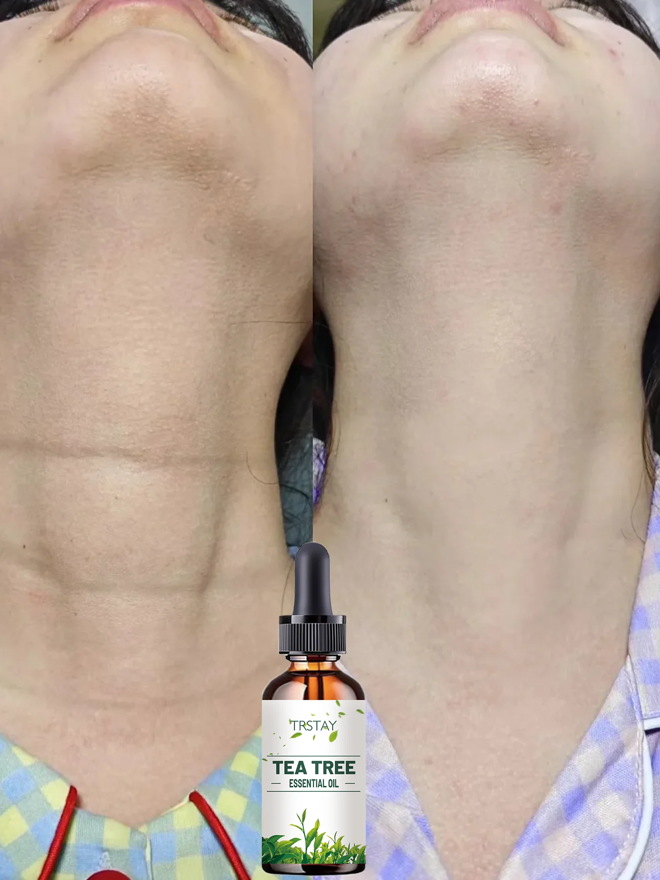 Alcohol-Free Neck Care Cream Hydration and Brightening Dual Action for Firmer Skin with Natural Extracts to Nourish and Rejuvena - Image 6