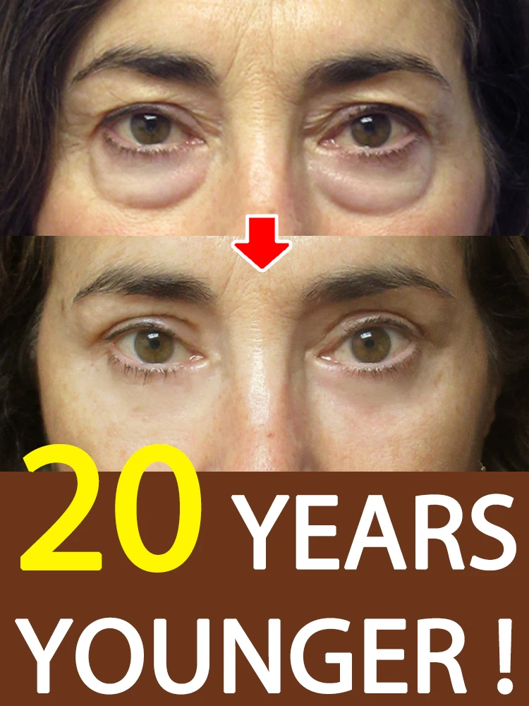 Eye Cream Remove Dark Circles Eye Bag Puffiness