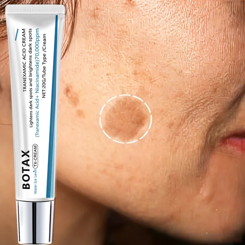 Water Ice Levin Tranexamic Aci - Skincare Niacinamide recension och pris