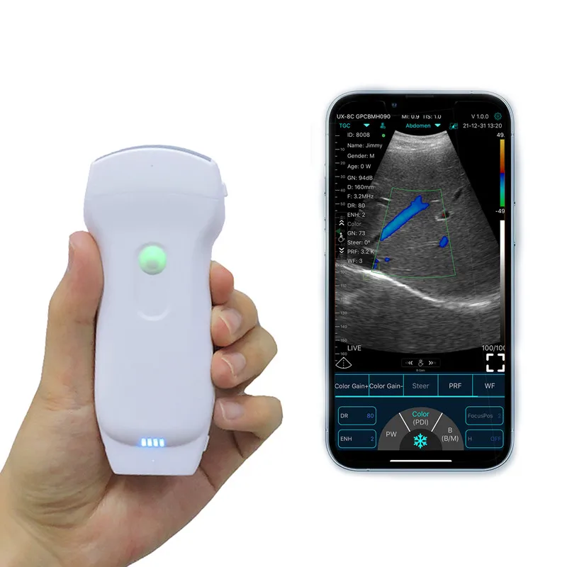 

Dog Doppler Ultrasound Corgi Digital Portable Wireless Probe Pet Scanner Linear Probe USG 128 Element Pet Hospital Sonar Device