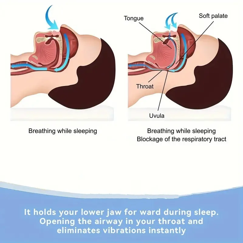 Anti Snoring Mouthpiece Professional Stop Snoring Mouth Guard Device BPA Free Custom Fit Silicone Night Guard for Teeth Grinding & Sleep Apnea, Adjustable Dental Appliance Guard for Men Women with Storage Case