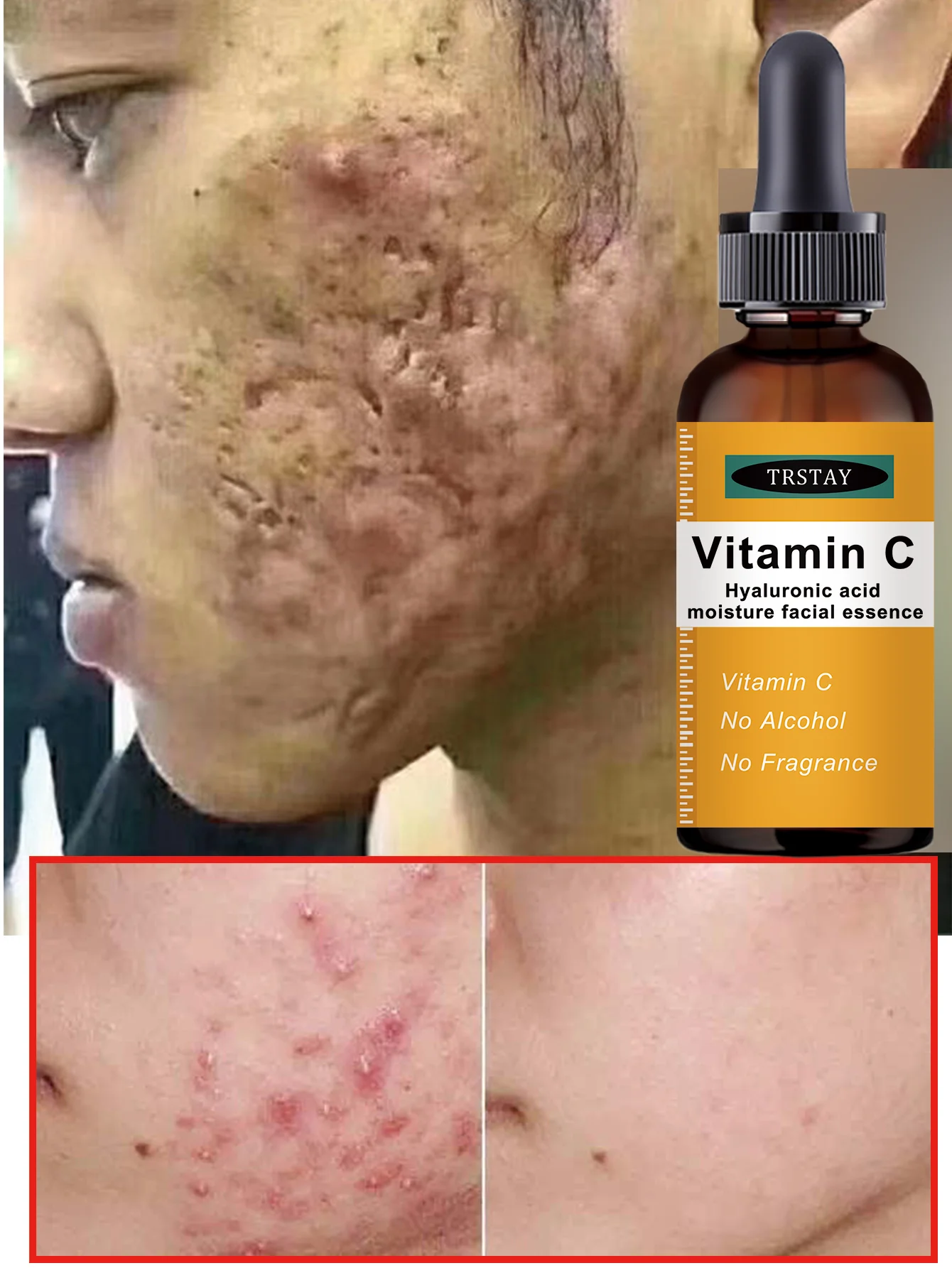 Hydrating Facial Oil for Post-Workout Skin Replenishes Lost Moisture Deeply Nourishes and Revitalizes Dull Complexion