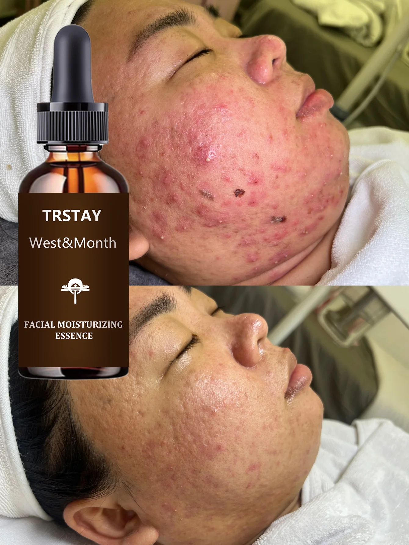 Deeply Lock Moisture Anti Wrinkle Serum Tighten Sagging Skin Enhance Elasticity Youthful Contours Facial Treatment Smooth Skin C - Image 6